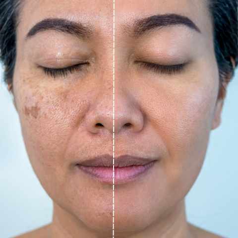 Bright Skin and Pigmentation Control Protocol